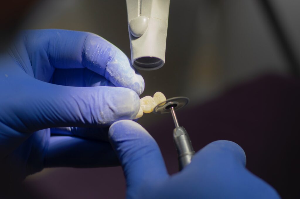 dentist creating one type of dental prosthesis device