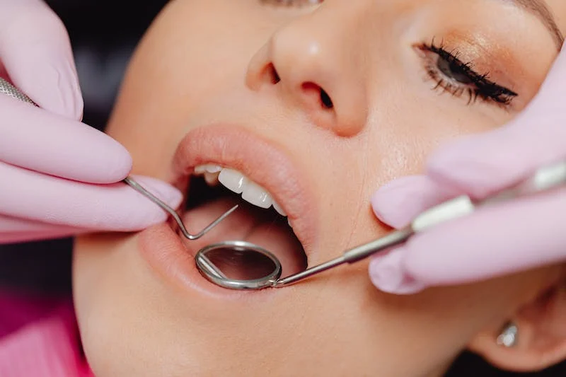 woman getting a dental exam for cavities