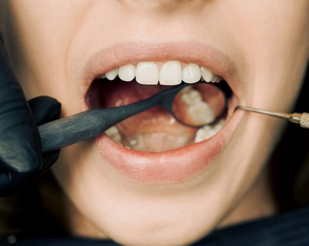 dental exam with mirror