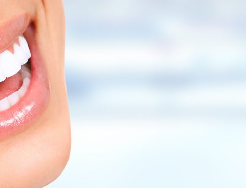 KöR Tooth Whitening